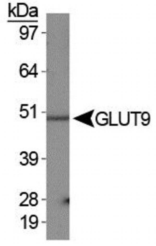 GLUT9 Antibody in Western Blot (WB)
