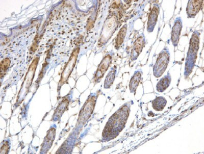 NBS1 Antibody in Immunohistochemistry (Paraffin) (IHC (P))