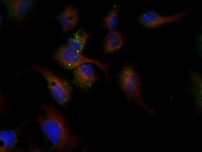 LDLR Antibody in Immunocytochemistry (ICC/IF)