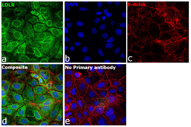 LDLR Antibody in Immunocytochemistry (ICC/IF)