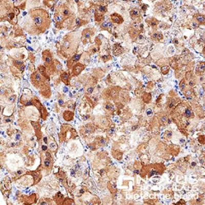 LDLR Antibody in Immunohistochemistry (Paraffin) (IHC (P))