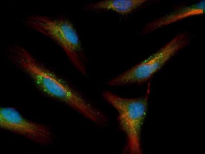 LC3A Antibody in Immunocytochemistry (ICC/IF)