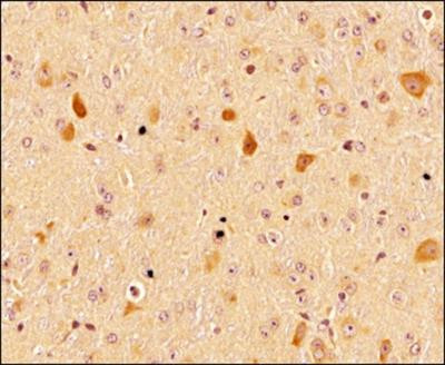 LC3A Antibody in Immunohistochemistry (Paraffin) (IHC (P))