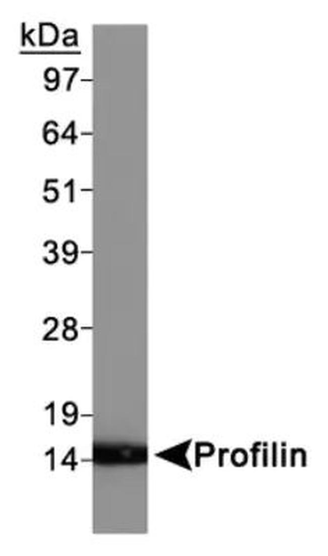 Profilin 1 Antibody in Western Blot (WB)