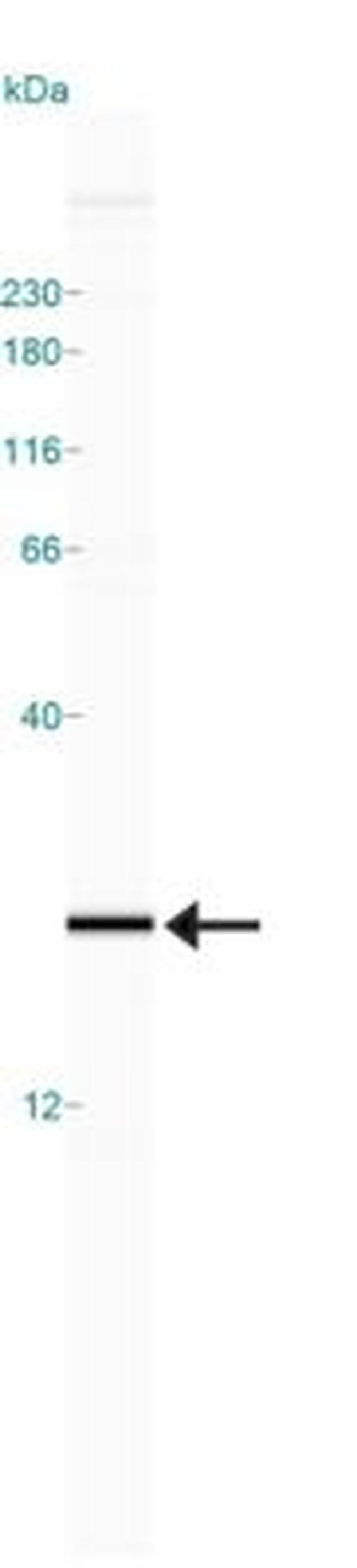 Profilin 1 Antibody in Western Blot (WB)