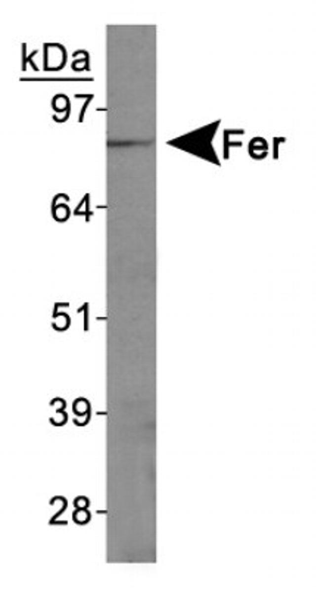 FER Antibody in Western Blot (WB)