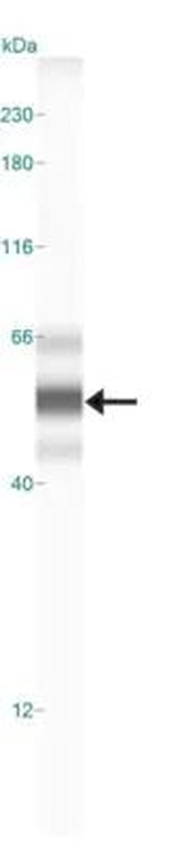 LOX Antibody in Western Blot (WB)