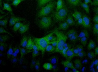 Folliculin Antibody in Immunocytochemistry (ICC/IF)