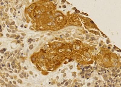 Folliculin Antibody in Immunohistochemistry (Paraffin) (IHC (P))