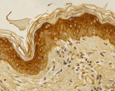 Folliculin Antibody in Immunohistochemistry (Paraffin) (IHC (P))