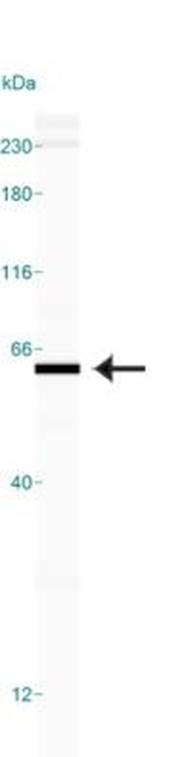 PKM2 Antibody in Western Blot (WB)