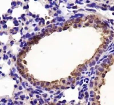 LDHA Antibody in Immunohistochemistry (Paraffin) (IHC (P))