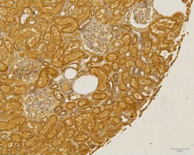 CCR2 Antibody in Immunohistochemistry (Paraffin) (IHC (P))