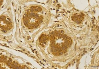 CCR2 Antibody in Immunohistochemistry (Paraffin) (IHC (P))