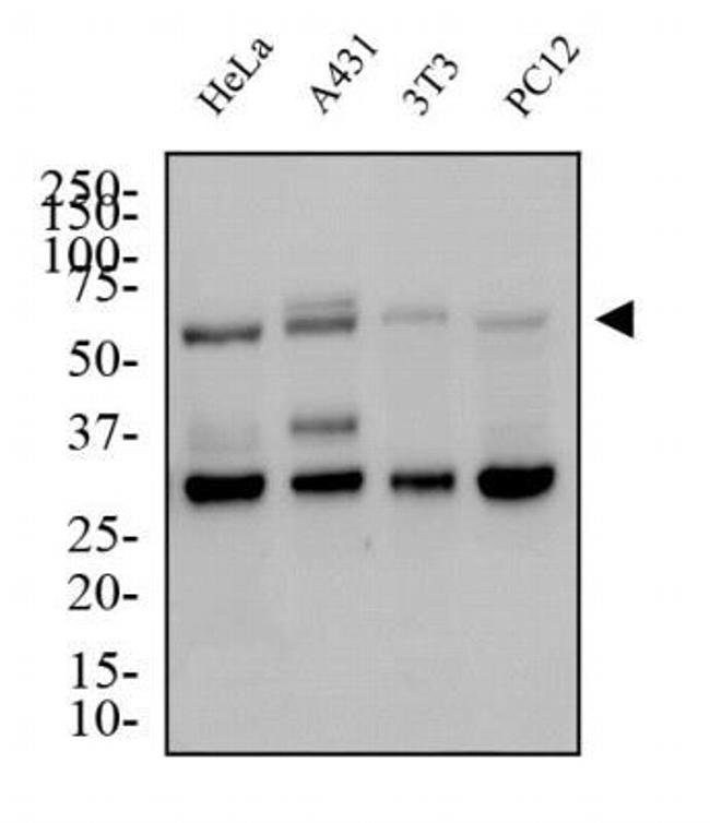 GLUT4 Antibody in Western Blot (WB)