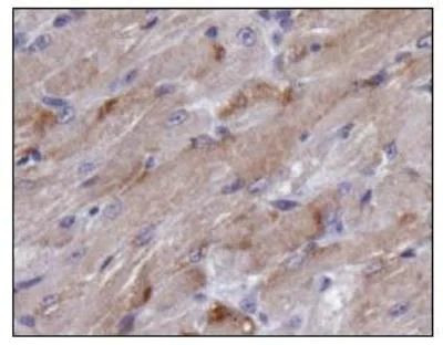 TIGAR Antibody in Immunohistochemistry (Paraffin) (IHC (P))