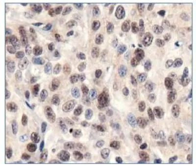 SIRT1 Antibody in Immunohistochemistry (Paraffin) (IHC (P))