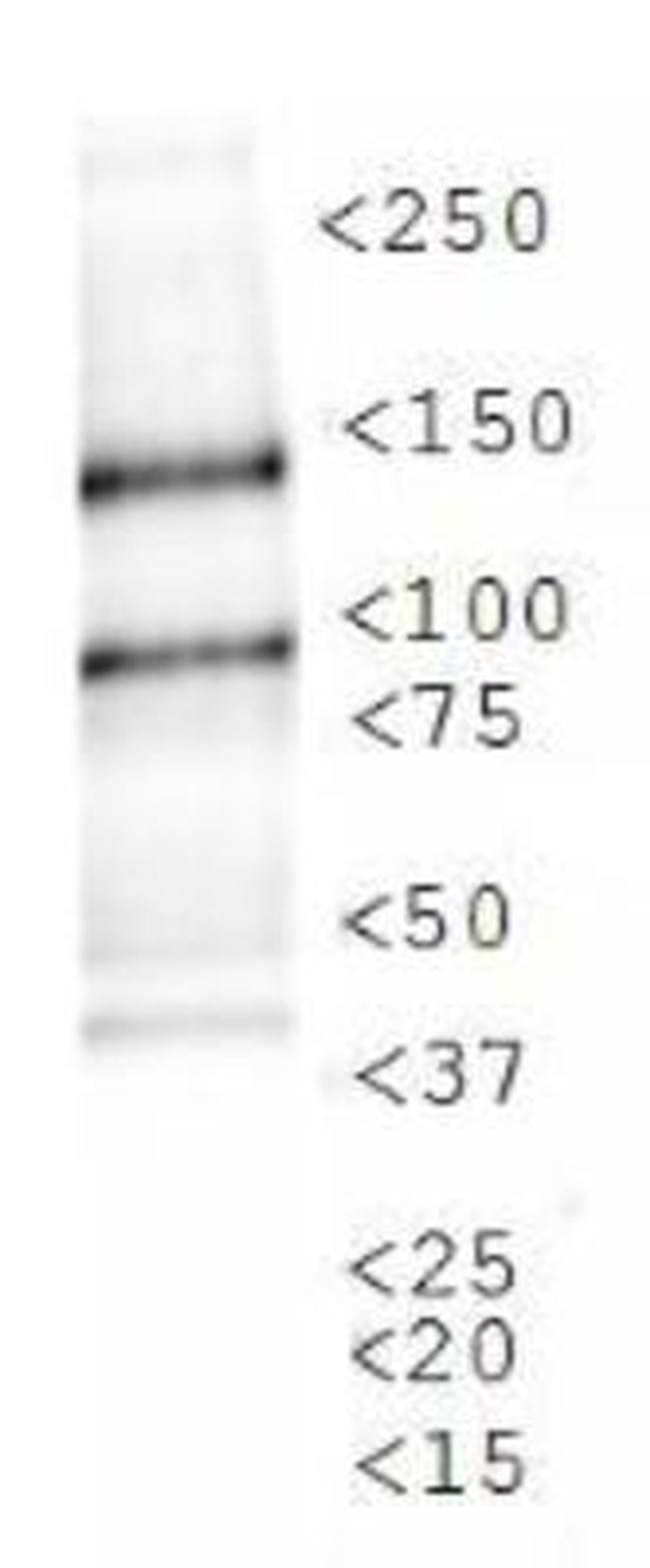 JMJD1A Antibody in Western Blot (WB)