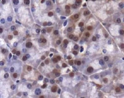 JMJD2A Antibody in Immunohistochemistry (Paraffin) (IHC (P))