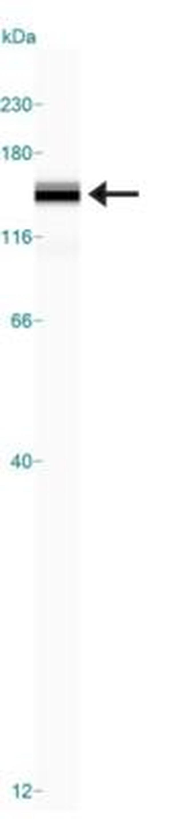 JMJD2A Antibody in Western Blot (WB)