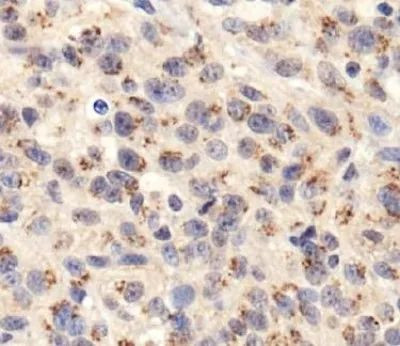 TGN46 Antibody in Immunohistochemistry (Paraffin) (IHC (P))