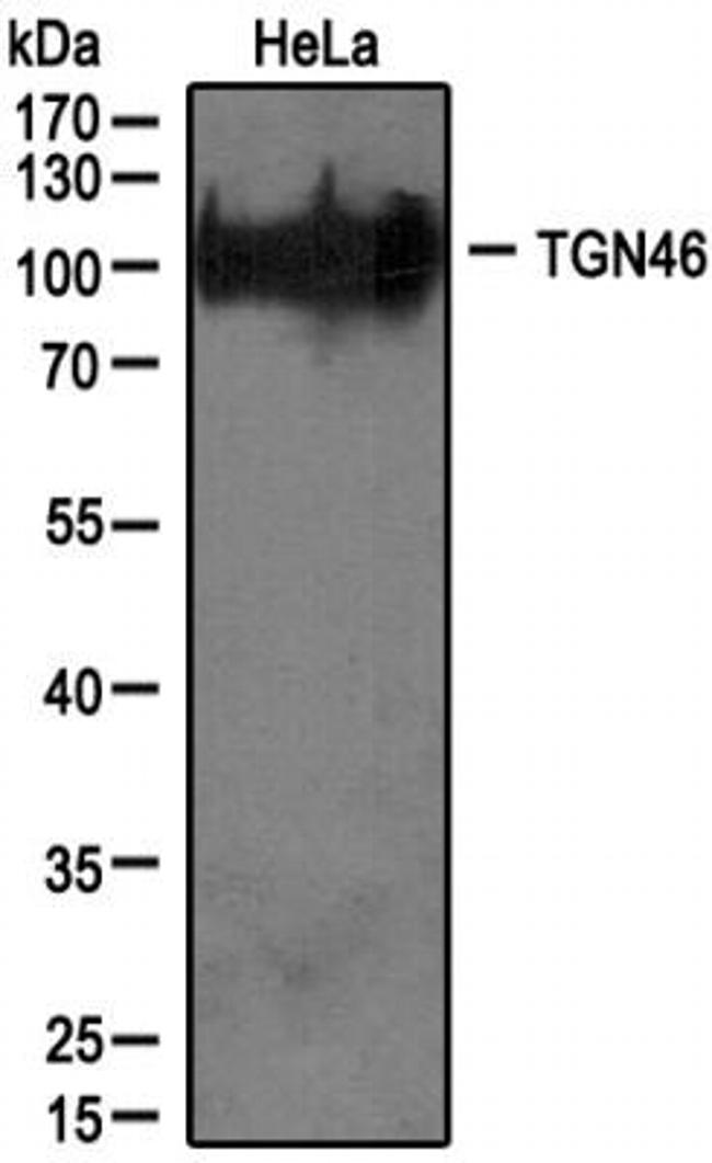 TGN46 Antibody in Western Blot (WB)