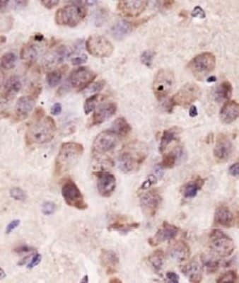 PINK1 Antibody in Immunohistochemistry (Paraffin) (IHC (P))