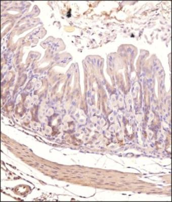 TEK Antibody in Immunohistochemistry (Paraffin) (IHC (P))