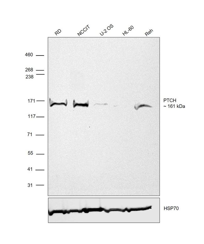 PTCH Antibody in Western Blot (WB)