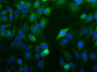 Nodal Antibody in Immunocytochemistry (ICC/IF)