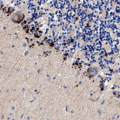 TRAIL-R2 (DR5) Antibody in Immunohistochemistry (Paraffin) (IHC (P))