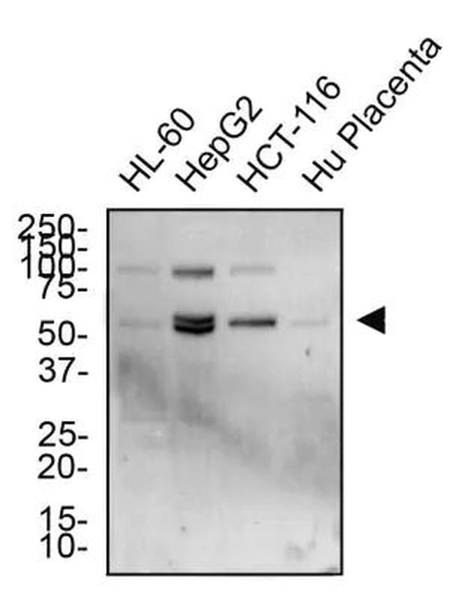 TRAIL-R2 (DR5) Antibody in Western Blot (WB)