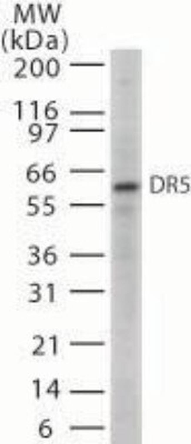 TRAIL-R2 (DR5) Antibody in Western Blot (WB)