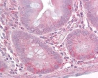 TLR1 Antibody in Immunohistochemistry (Paraffin) (IHC (P))