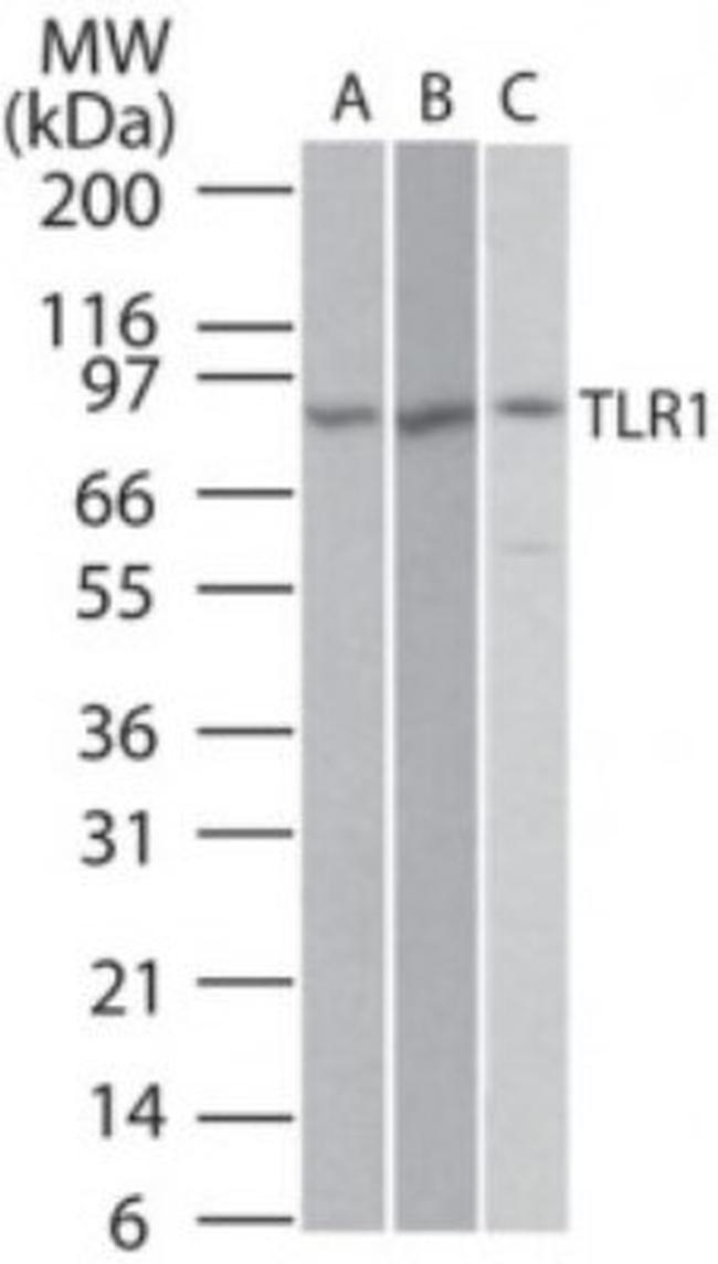 TLR1 Antibody in Western Blot (WB)