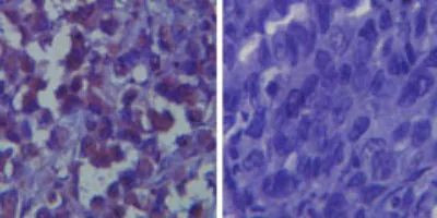 TLR6 Antibody in Immunohistochemistry (Paraffin) (IHC (P))