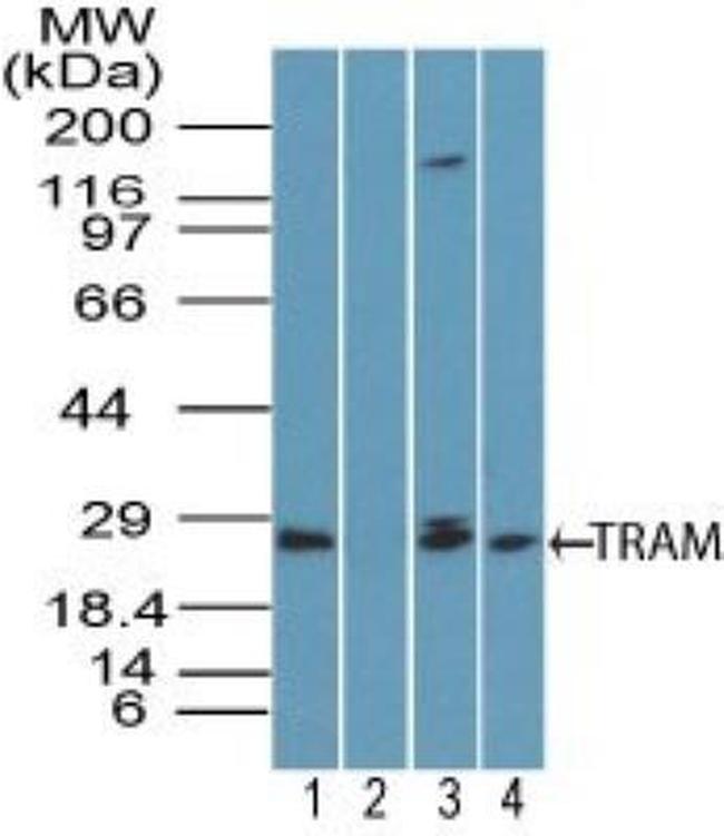 TICAM2 Antibody in Western Blot (WB)