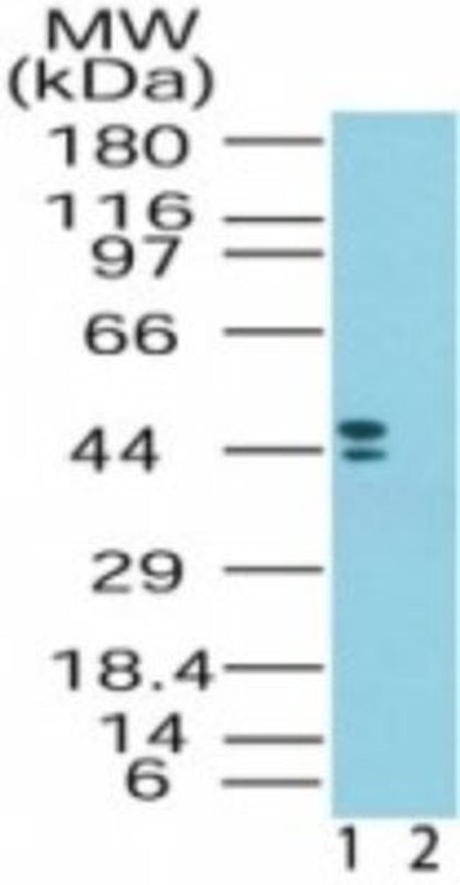 CRHR2 Antibody in Western Blot (WB)