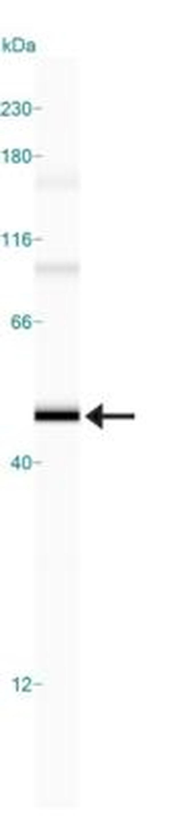 CRHR2 Antibody in Western Blot (WB)