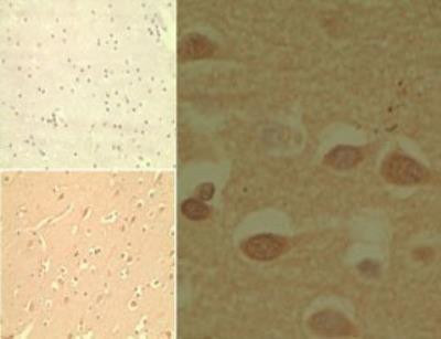 MD-2 Antibody in Immunohistochemistry (Paraffin) (IHC (P))