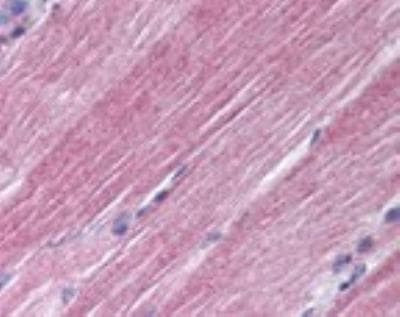 RAB7 Antibody in Immunohistochemistry (Paraffin) (IHC (P))