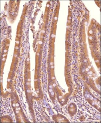 Sorcin Antibody in Immunohistochemistry (Paraffin) (IHC (P))