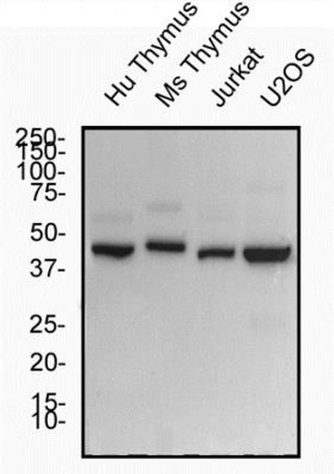 ROR gamma Antibody in Western Blot (WB)