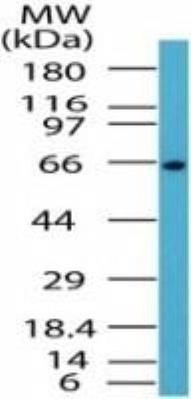 NFkB p65 Antibody in Western Blot (WB)