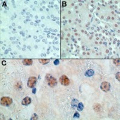 MSX1 Antibody in Immunohistochemistry (Paraffin) (IHC (P))