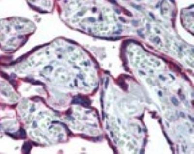 GRP94 Antibody in Immunohistochemistry (Paraffin) (IHC (P))