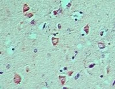 LC3A Antibody in Immunohistochemistry (Paraffin) (IHC (P))