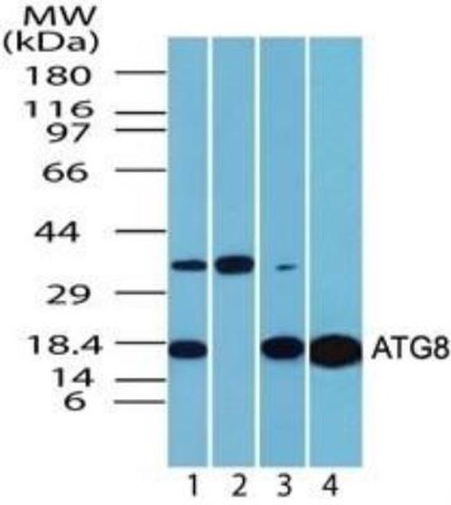 LC3A Antibody in Western Blot (WB)