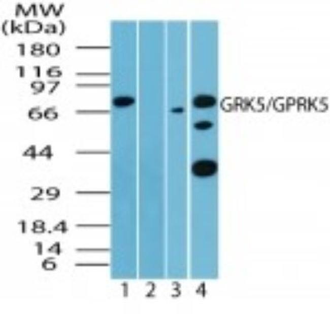 GRK5 Antibody in Western Blot (WB)