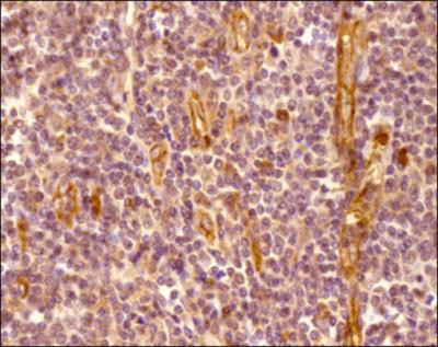 CXCR7 Antibody in Immunohistochemistry (Paraffin) (IHC (P))